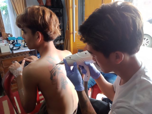 Hapus tato gratis karawang