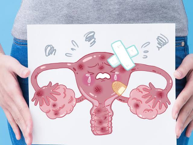 images - 2023-03-01T185143.437 Gejala kanker serviks