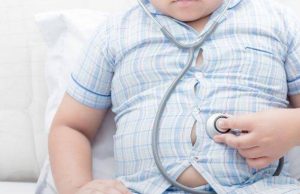 1.440 Balita di Bekasi Menderita Obesitas, Kok Bisa? Balita obesitas di bekasi