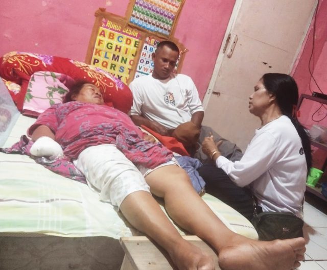 Tarik tambang di karawang jari tangan diamputasi