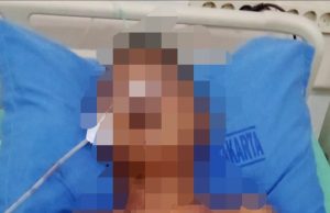 Masih Koma, Bocah Disabilitas yang Dimassa di Karawang Dipindah ke RSUD Purwakarta Bocah disabilitas di purwakarta