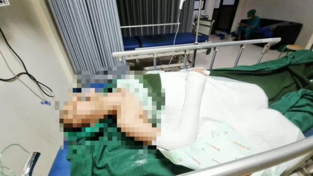 Siswi sd karawang korban bullying