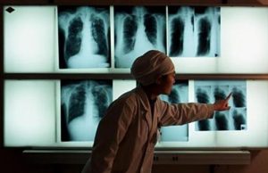 Lima tahun kasus tbc di karawang