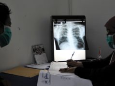 Obat gratis pasien tb