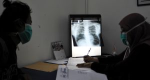 Obat gratis pasien tb