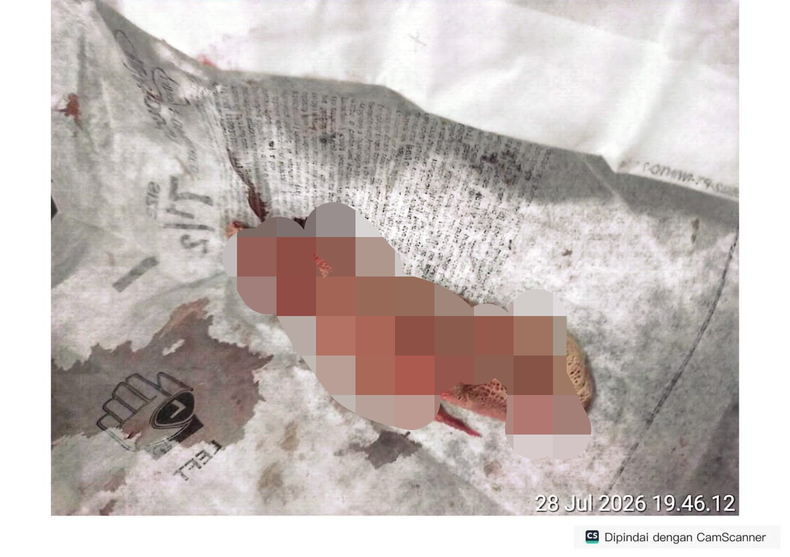 Malapraktik rs operasi di karawang